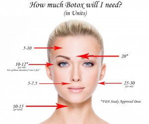 How much Botox do I need? - Refreshed Aesthetic Surgery Blog
